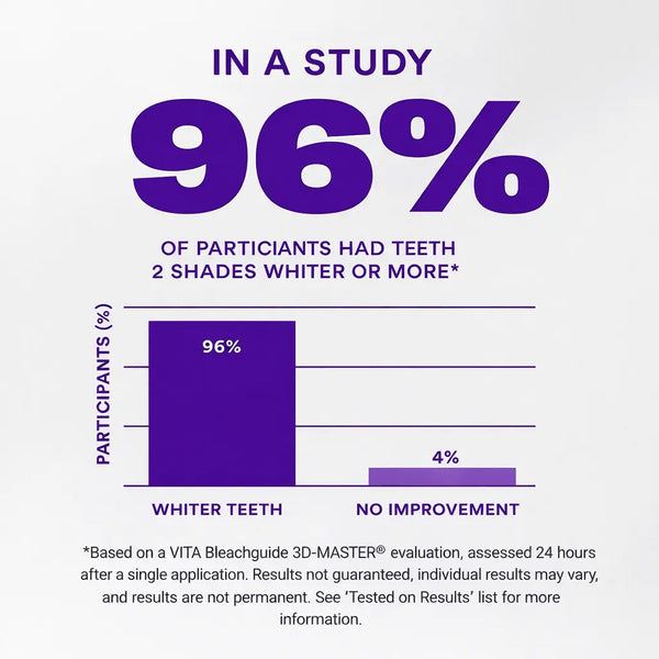 Color Correcting Whitening Strips - Smilekit™ - Velora